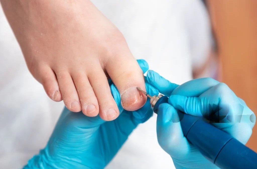Comprehensive Guide to Ingrown Toenail Treatment: When to Seek Professional Help