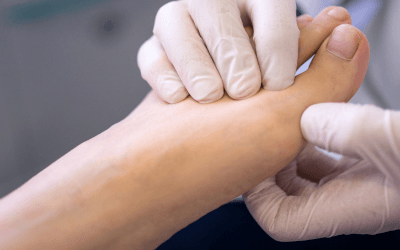 Do I Need to See a Podiatrist? Here’s What You Should Know